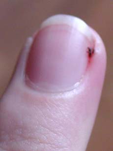 My finger as of Monday morning.